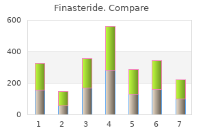 buy generic finasteride 5mg on line